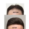 Color 4 (Dark Brown), Men's Frontal Hairpiece Specially Designed to Cover Receding Hairline, Made With Remy Indian Human Hair